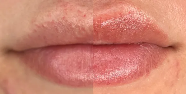 Close up of lip blush permanent makeup tattoo