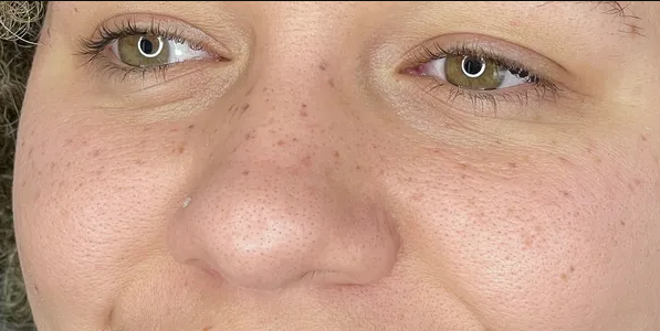 Natural tattooed freckles and beauty marks on face